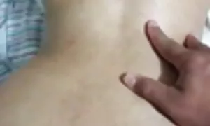 ka anal prolapse mos ...
