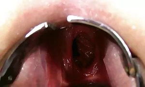 habeli anal fisting, ...