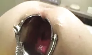anal, kgolo le sehlo ...
